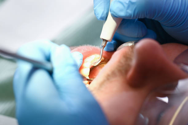 Best Emergency Tooth Extraction  in Long Grove, IA