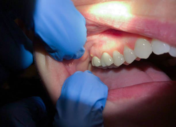 Best Cracked Tooth Emergency Dentist  in Long Grove, IA